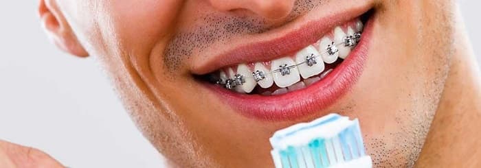 در زمان خرید خمیر دندان مناسب ارتودنسی باید به چه نکاتی دقت کنید؟