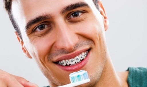 پاک کردن پلاک دندان با مسواک برای مراقبت از بریس‌های دندانپزشکی