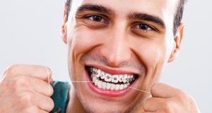 چگونه از نخ دندان ارتودنسی استفاده کنیم